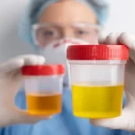 How Long Does Synthetic Urine Last? Key Factors Affecting Its Expiration