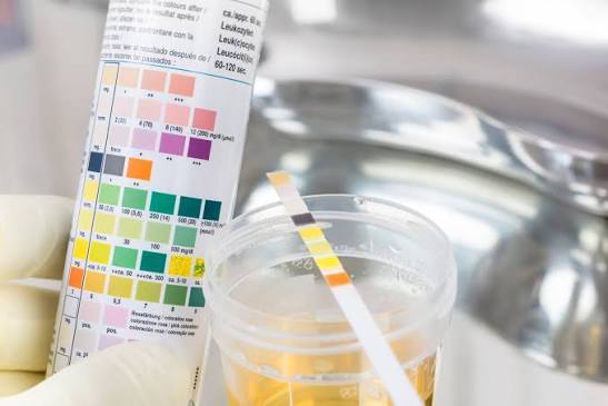 Artificial urine